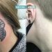 Tattoo Removal