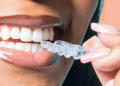 Pictures of Teeth Without Enamel