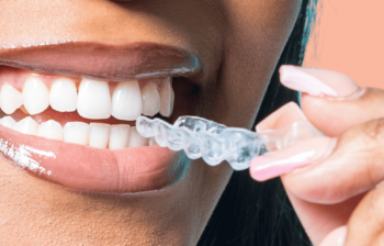 Pictures of Teeth Without Enamel