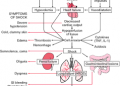 Hypoperfusion