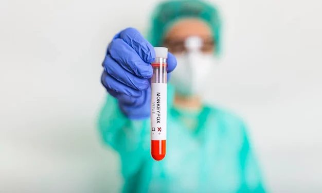 Virus