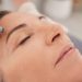 Skin Needling