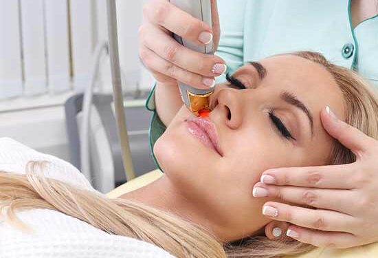 Laser Hair Removal