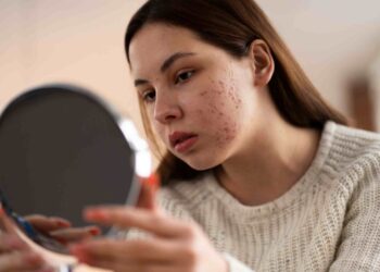 Acne Prevention: Stress, Diet, Exercise, Sleep, and More